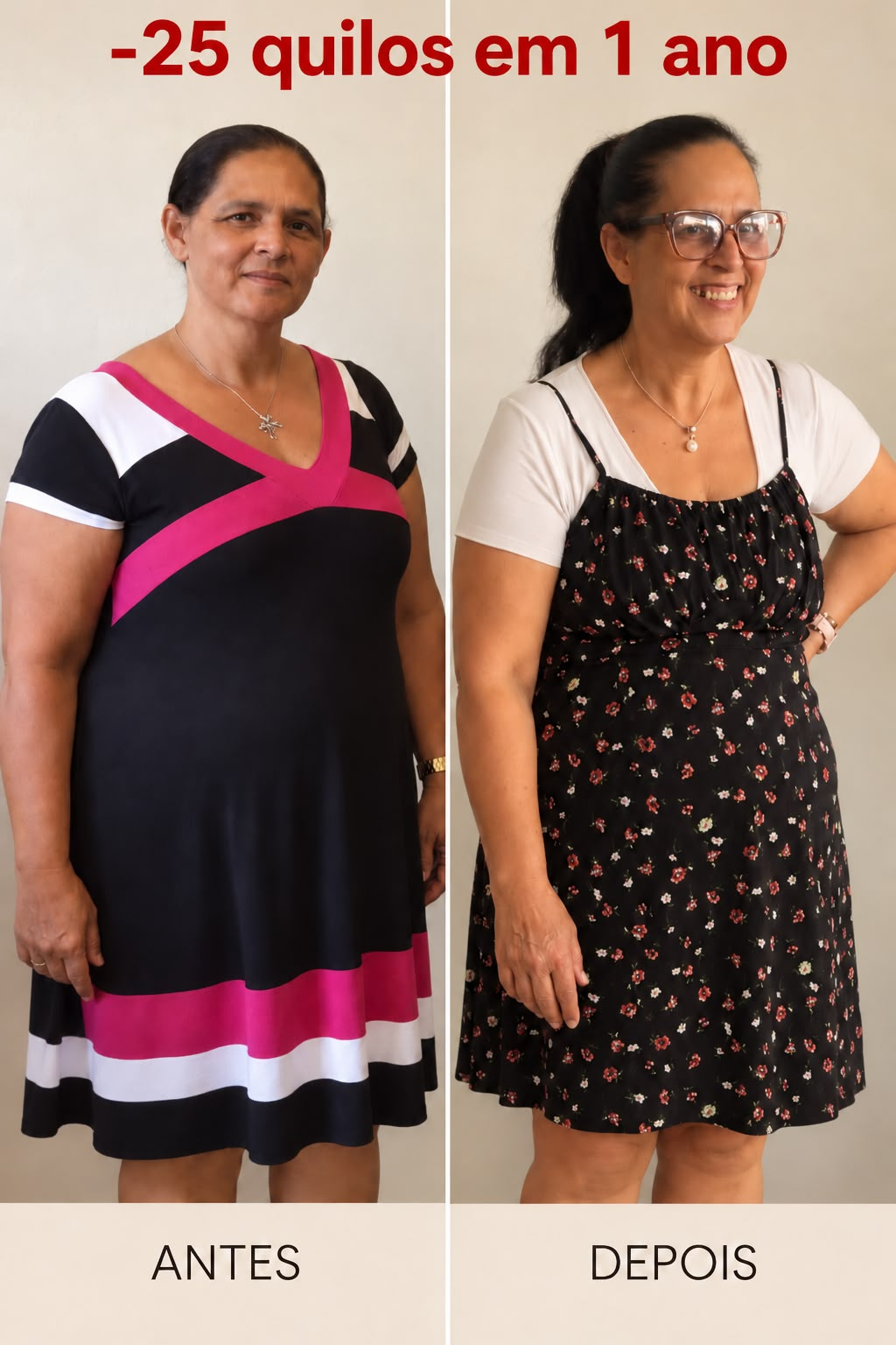 Ivone antes e depois: 25 quilos a menos em 1 ano com reeducação alimentar